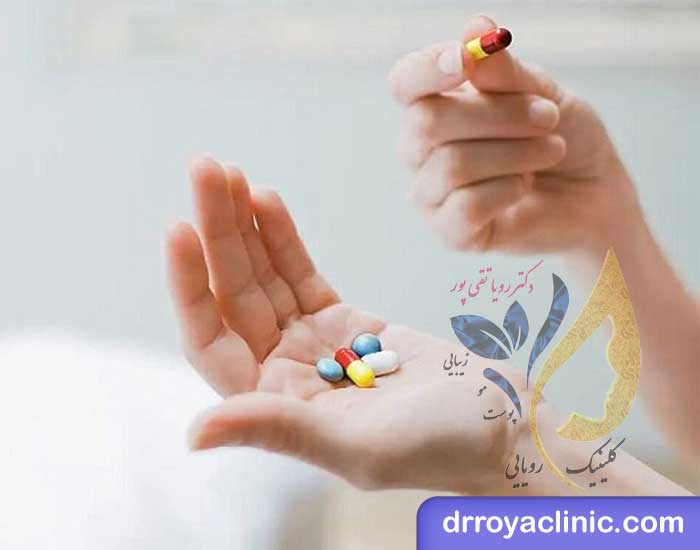 مراقبت های بعد از بلفاروپلاستی