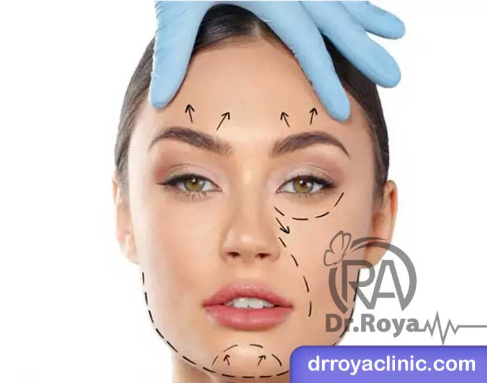 معایب عمل لیفت صورت با نخ