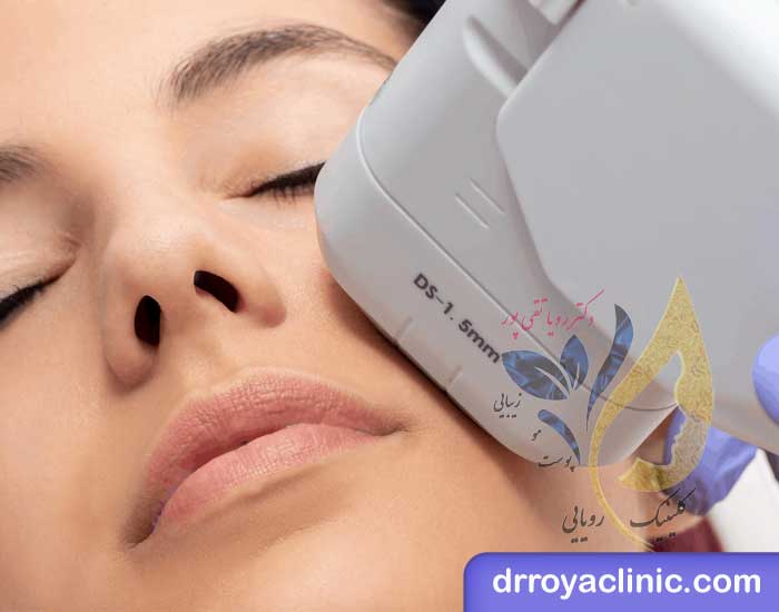 عوارض هایفوتراپی صورت