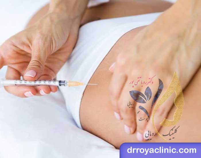 روش های رفع هیپ دیپ یا فرورفتگی بغل ران