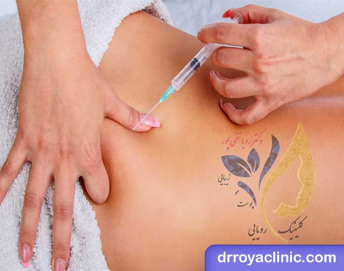 مراقبت های قبل و بعد از تزریق ژل باسن