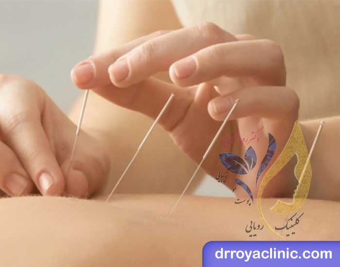طب سنتی چه تفاوتی با امبدینگ دارد؟
