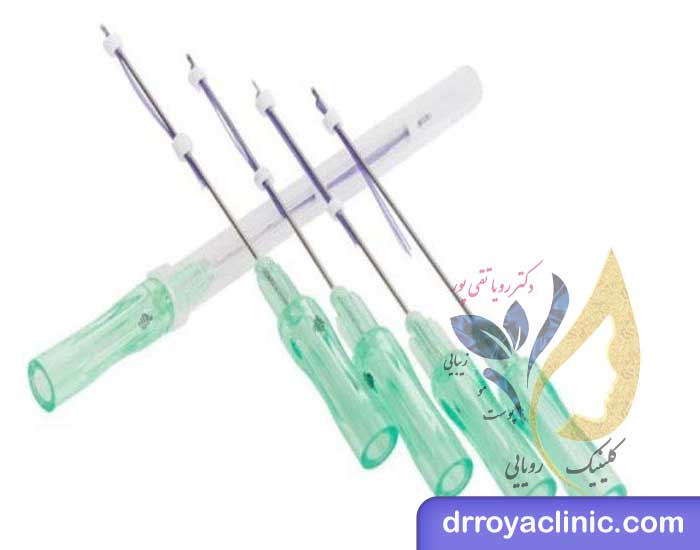 کاهش وزن به روش امبدینگ