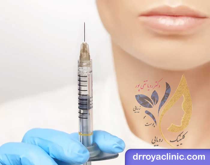 ماندگاری فیلر بادی چه مدت است؟