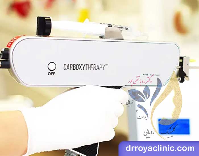 کربوکسی تراپی واژن