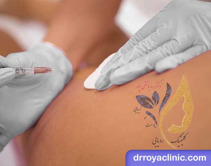 تزریق ژل برای خوش فرم کردن باسن