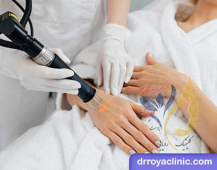 استفاده از لیزر برای جوانسازی دست