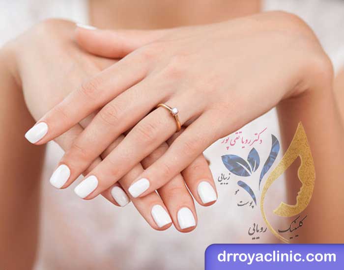هایفوتراپی جوانسازی دست