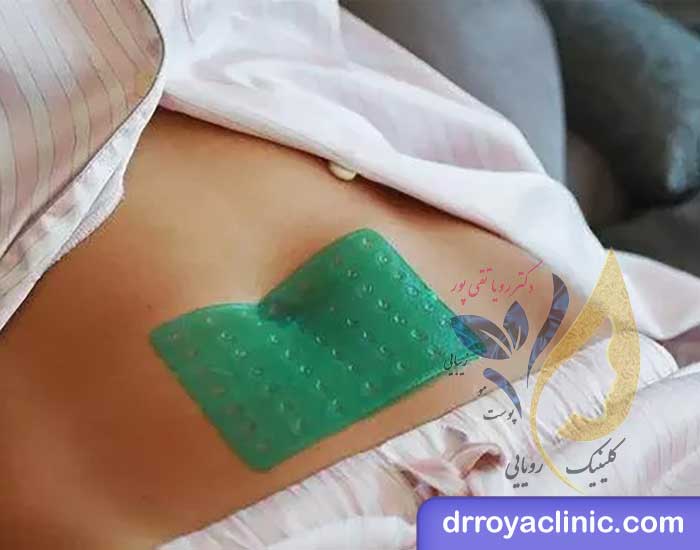 قرص ناف چیست