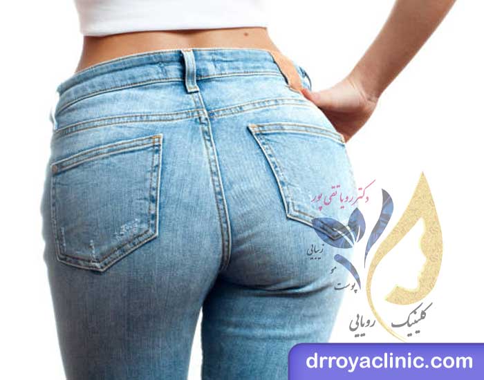 ژل و چربی برای حجم‌ دهی باسن