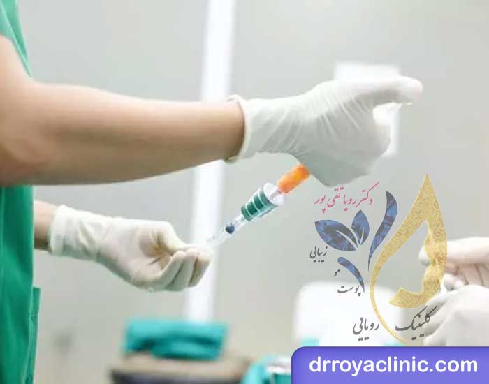 تزریق ژل و چربی برای حجم ‌دهی باسن دائمی است