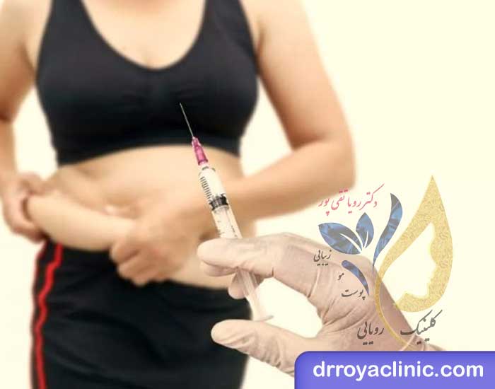 مزوتراپی شکم و میزان تاثیرگذاری آن