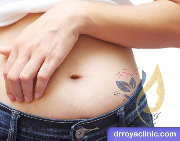 کیس های ممنوعه مزوتراپی شکم