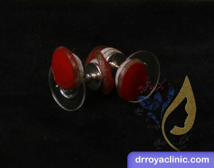 مضرات و خطرات استفاده از گوشواره‌ لاغری