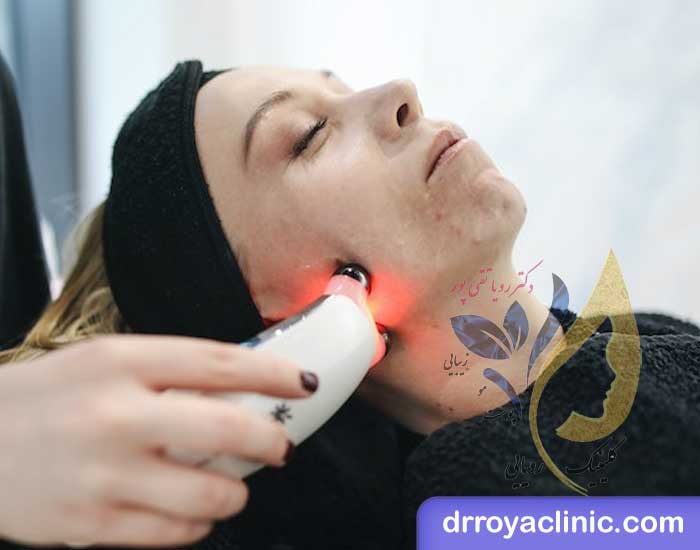 نکات پیشگیری از عوارض فیشیال صورت