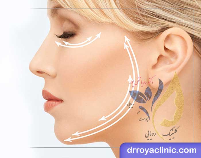 تفاوت بوتاکس و مزوبوتاکس