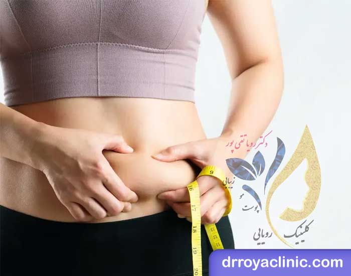 تعداد جلسات امبدینگ در تهران