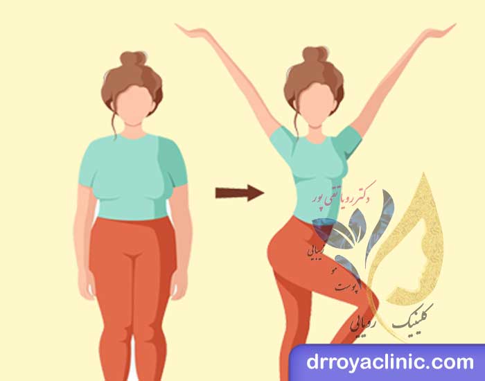 ویژگی های بهترین کلینیک لاغری در اصفهان