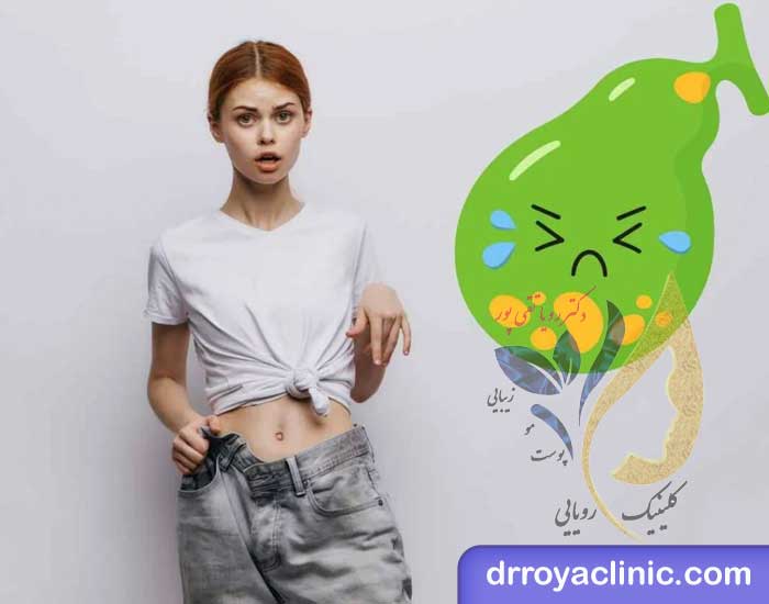 لاغری بعد از عمل کیسه صفرا