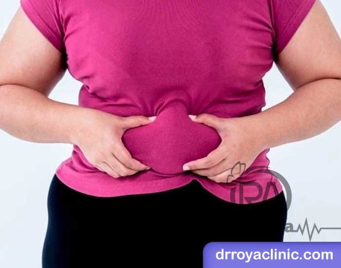 کاهش وزن سریع قبل از عروسی