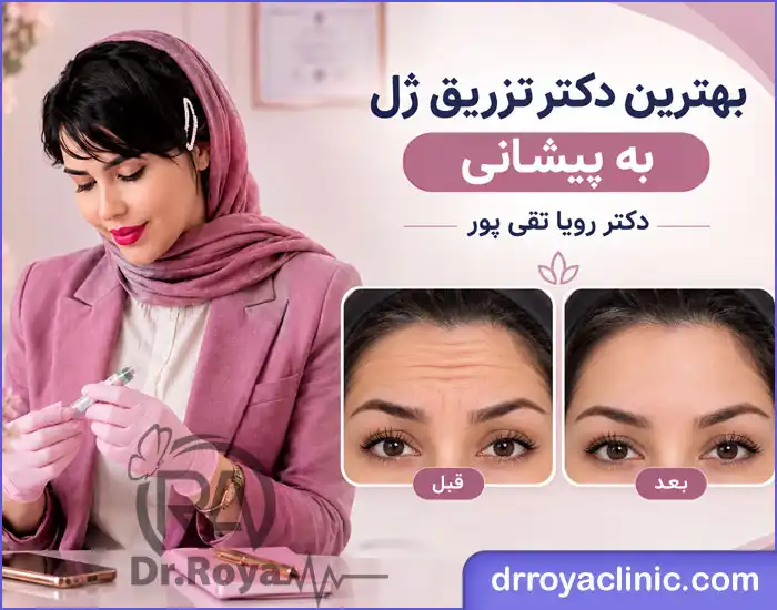 بهترین دکتر تزریق ژل به پیشانی در اصفهان