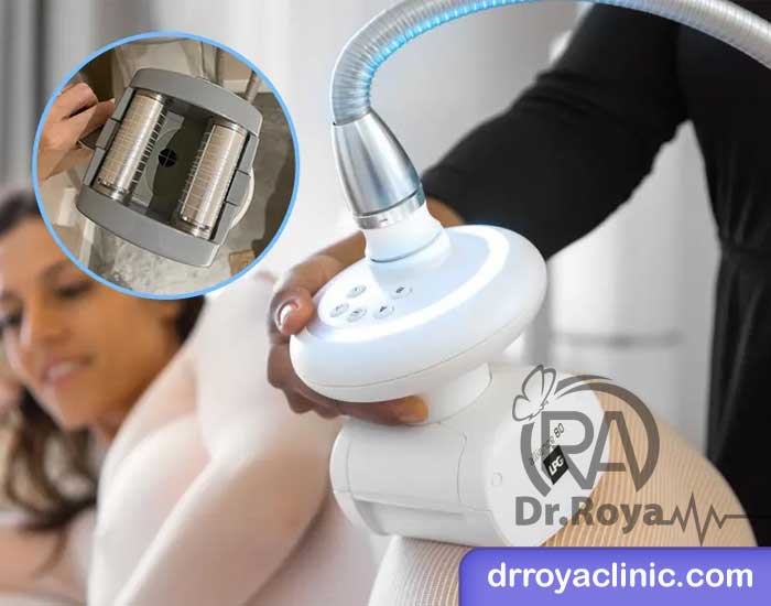 مزایای لاغری با دستگاه ال پی جی