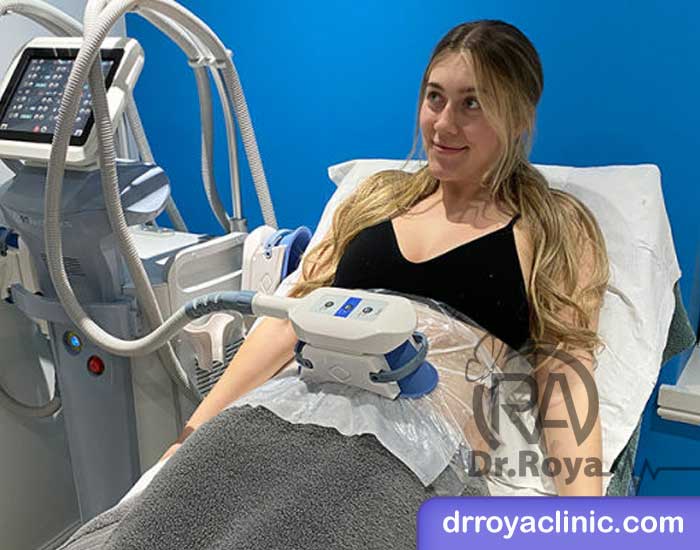 مزایای لاغری با دستگاه کرایولیپولیز