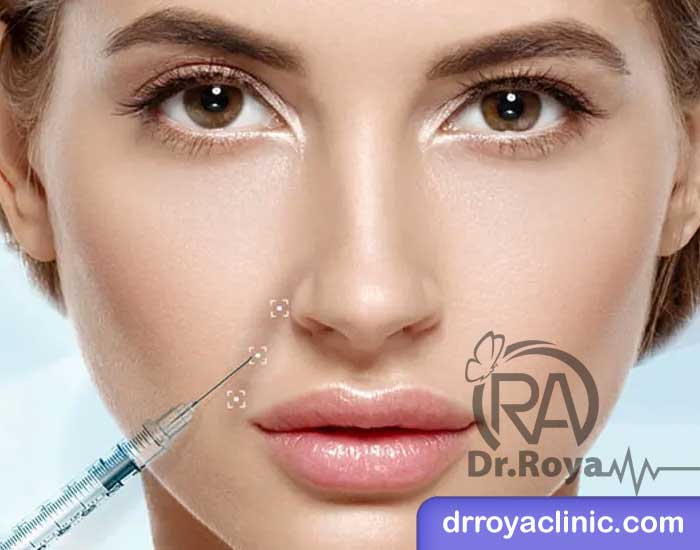 نحوهٔ تزریق ژل خط خنده