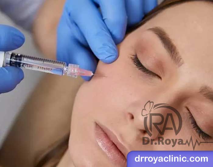 قیمت تزریق ژل پروفایلو در کلینیک زیبایی رویایی آبی