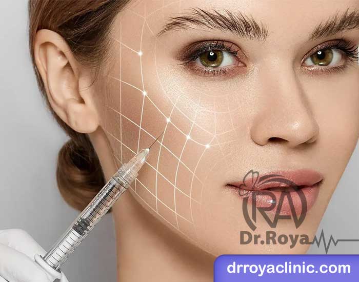 طریقه استفاده از ژل پروفایلو