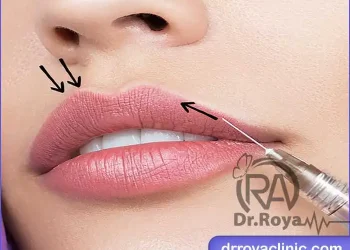ژل لب روسی در شاهین شهر