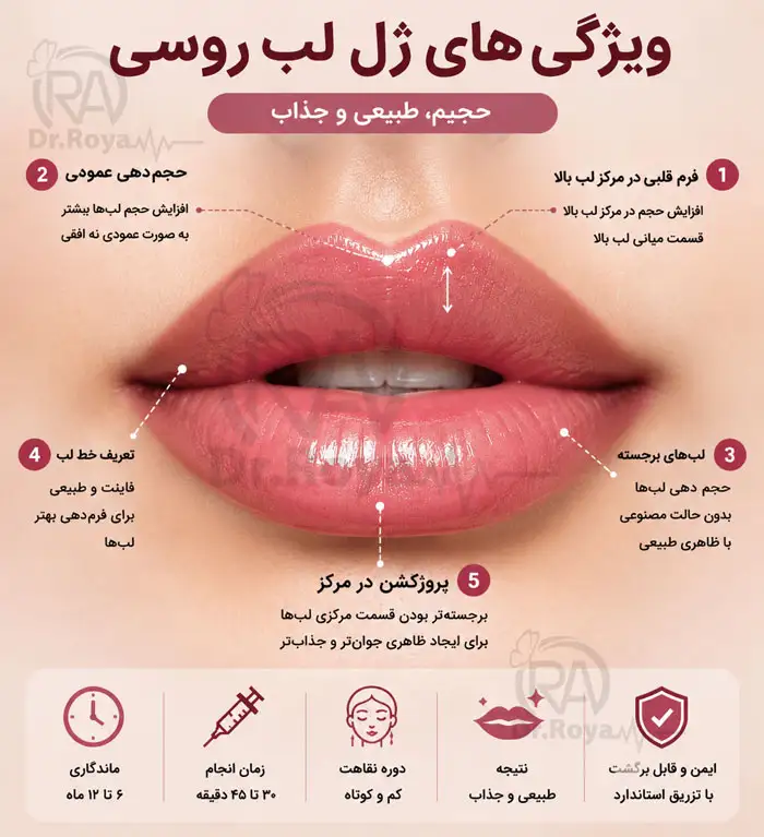 ژل لب روسی چه ویژگی‌ هایی دارد؟