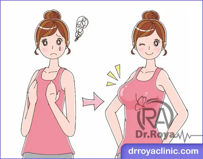 فیلر بادی در فولادشهر