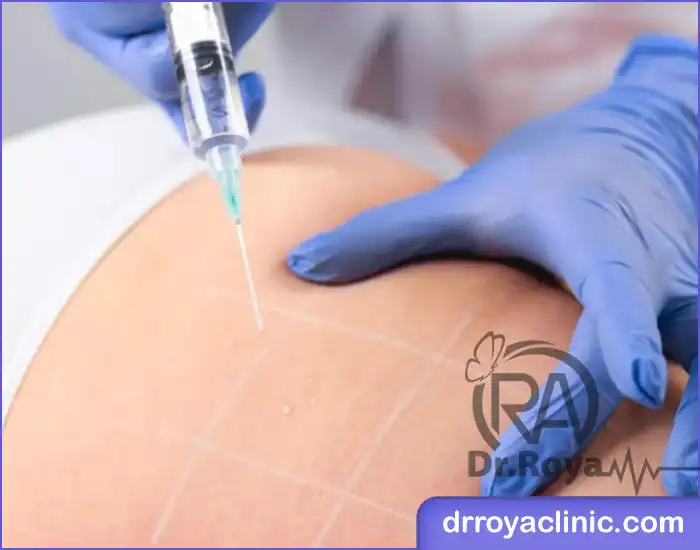 تزریق ژل به بدن در شهرکرد