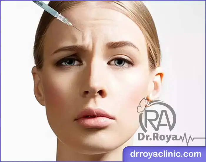میزان بوتاکس مورد نیاز برای هر ناحیه خط اخم