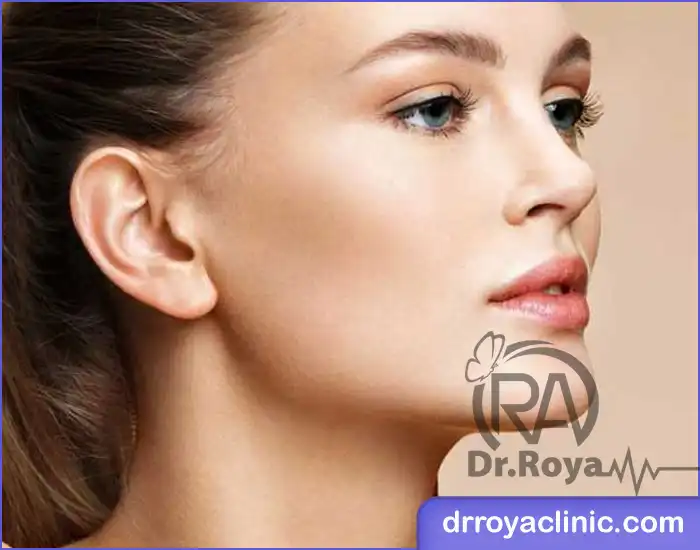 کاندیدای زاویه سازی صورت در اصفهان