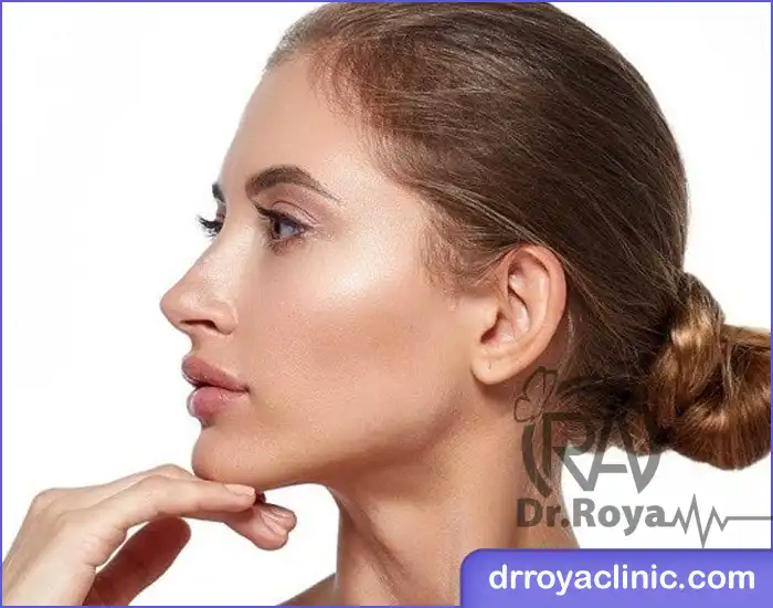 زاویه سازی صورت در شاهین شهر