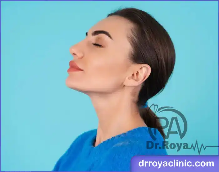 بهترین دکتر زاویه سازی صورت در شهرکرد