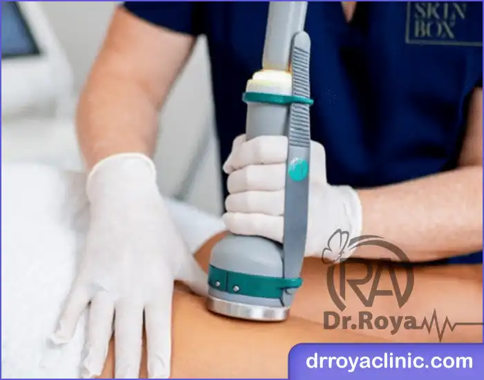دستگاه لاغری اوندا برای چه نواحی از بدن مناسب است؟