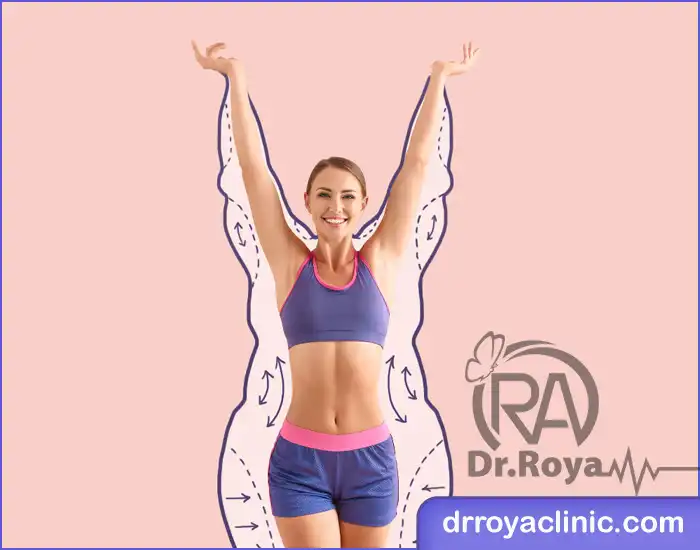 نخ لاغری در فریدون شهر
