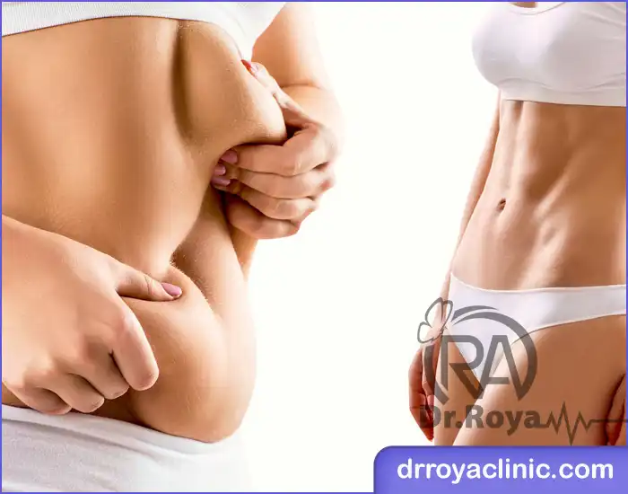 لاغری با نخ لاغری در شهرکرد