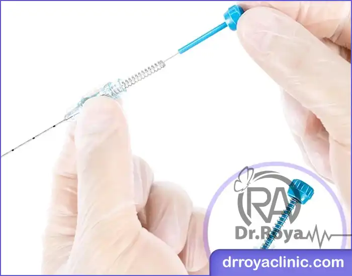 امبدینگ در شهرکرد