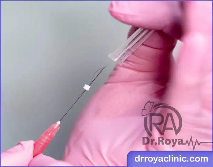 هزینه امبدینگ در زرین شهر