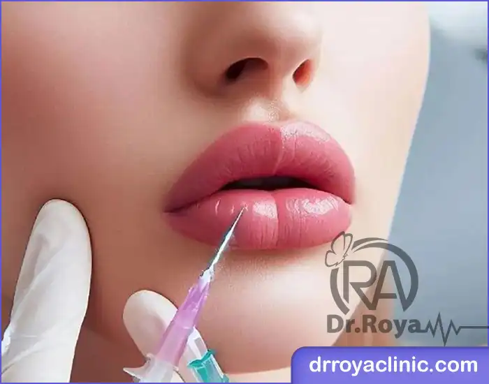 بهترین پزشک برای تزریق انواع مدل ژل لب