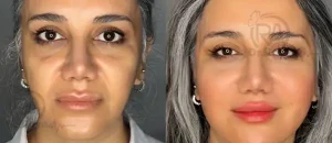 بهترین دکتر کانتورینگ صورت در شهرکرد