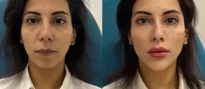 بهترین دکتر کانتورینگ صورت در شهرکرد