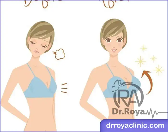 هزینه فیلر بادی در اهواز