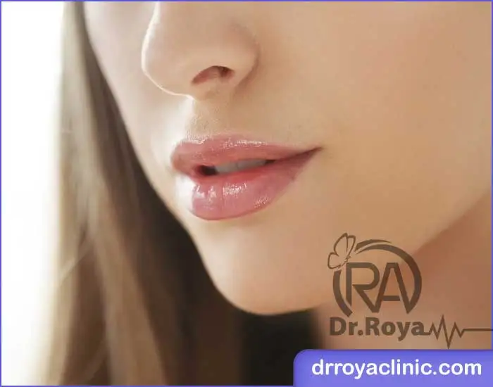 ژل لب در شاهین ‌شهر توسط پزشک متخصص