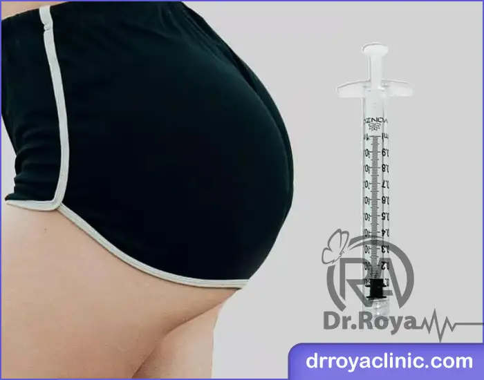 تزریق ژل به باسن در شهرکرد