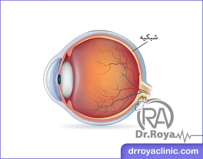 ریشه نابینایی با مانجارو از کجاست؟
